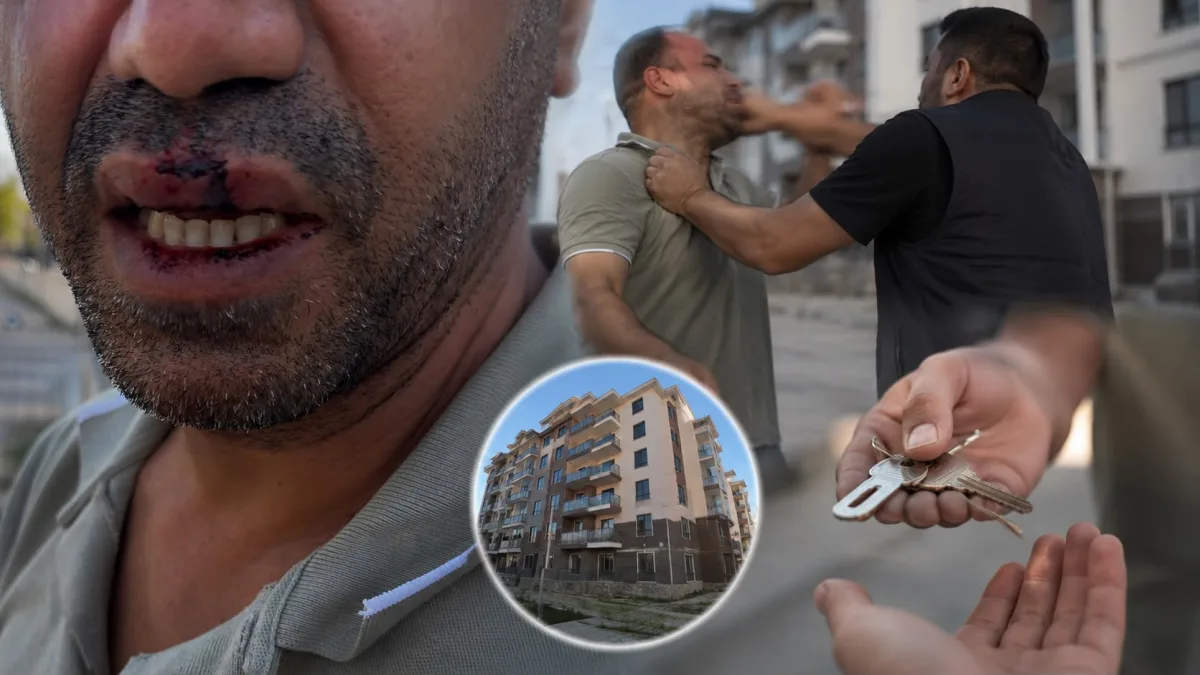 Malatya'da hak sahibi olduğunu iddia eden vatandaş darp edildi: Eksikleri bildirdi, para istendiğini öne sürdü