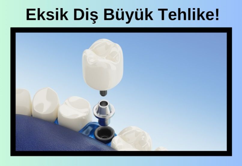 Eksik Diş Sağlık İçin Büyük Tehlike!