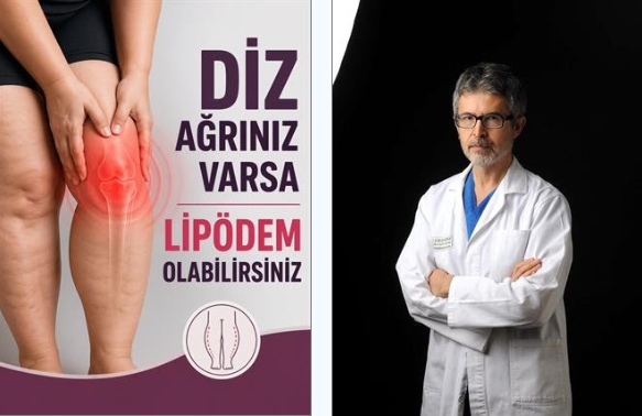 NEDENİ BİLİNMEYEN DİZ AĞRILARININ ALTINDAN ‘LİPÖDEM’ ÇIKABİLİR!