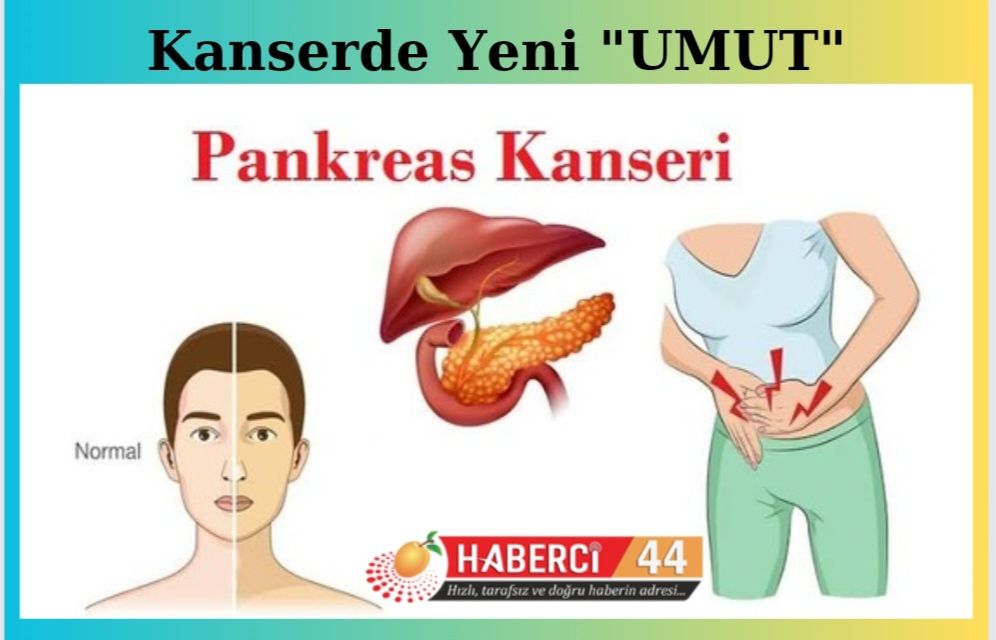 PANKREAS KANSERİNDE YENİ UMUT: FOSFOR 32